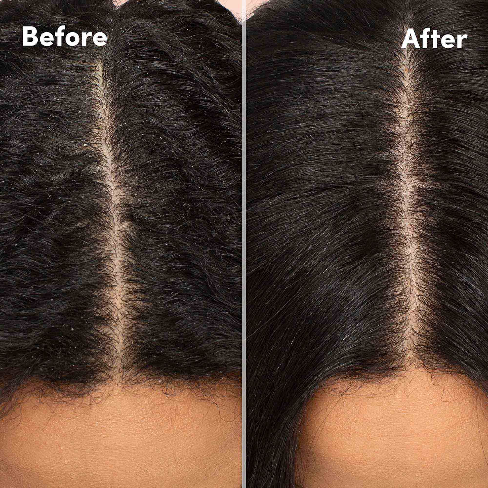 Scalp Care Hydrating Shampoo